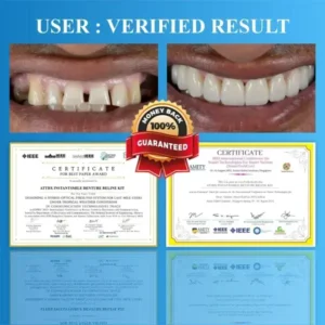 ATTDX™ InstantSmile Denture Reline Kit