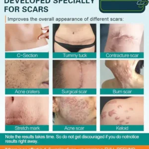 Advanced Scar Spray For All Types of Scars