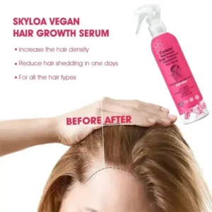 Cvreoz BeeVenom Scalp Care HairGrowth Hair Spray