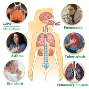 Futusly™ Herbal Lung Cleansing Inhaler