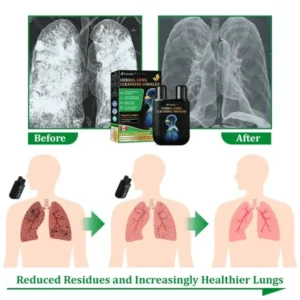 Futusly™ Herbal Lung Cleansing Inhaler