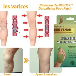 NEGUSY™ LymphTox Bee Venom Foot Patches