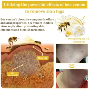 Turonu™ New Zealand Bee Venom Skin Treatment Cream