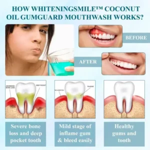 WhiteningSmile™ Coconut Oil GumGuard Mouthwash